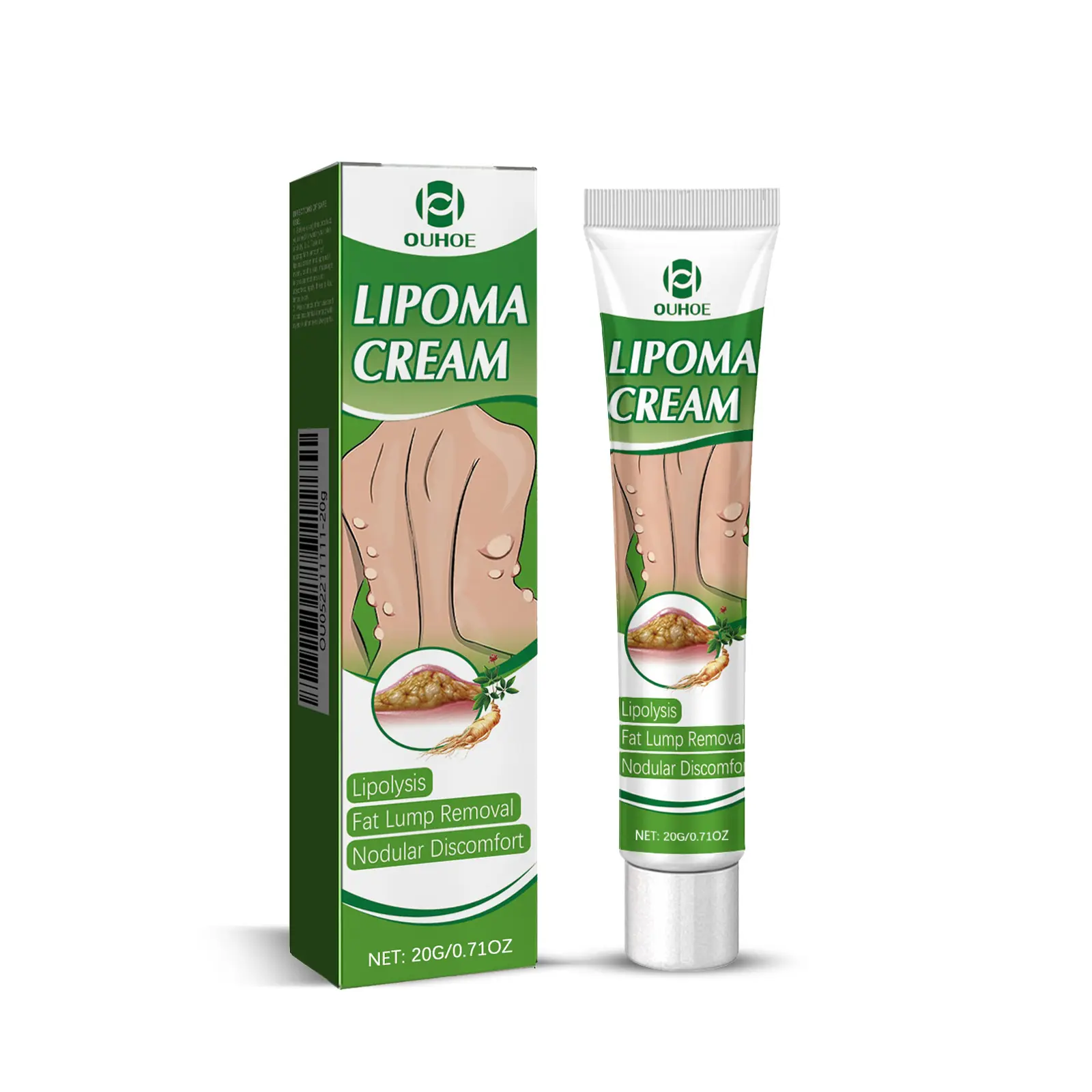 OUHOE Lipoma Care Cream, soothes subcutaneous fat lumps and nodules, helps relieve body fatty masses for daily body care.Buy 1 Get 1 Free, you will receive 2 boxes in total.#LipomaCream#Body Care#FatLumpRelief#SubcutaneousNoduleCare#Buy1Get1Free