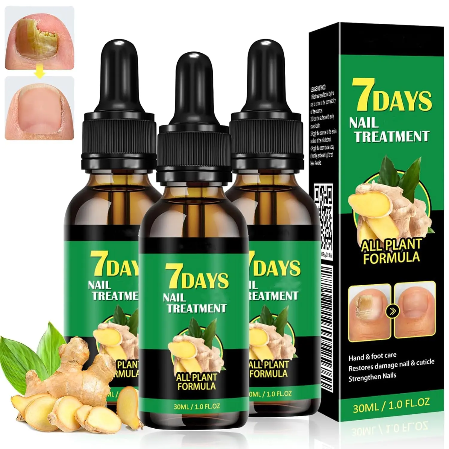 JAYSUING Ginger Nail Treatment – Thick Nails Softener & Discoloration Corrector, Ginger Turmeric Extract with Vitamin E, Strengthens Brittle Peeling Nails, Cuticle Repair Oil for Toe and Fingernail Recovery