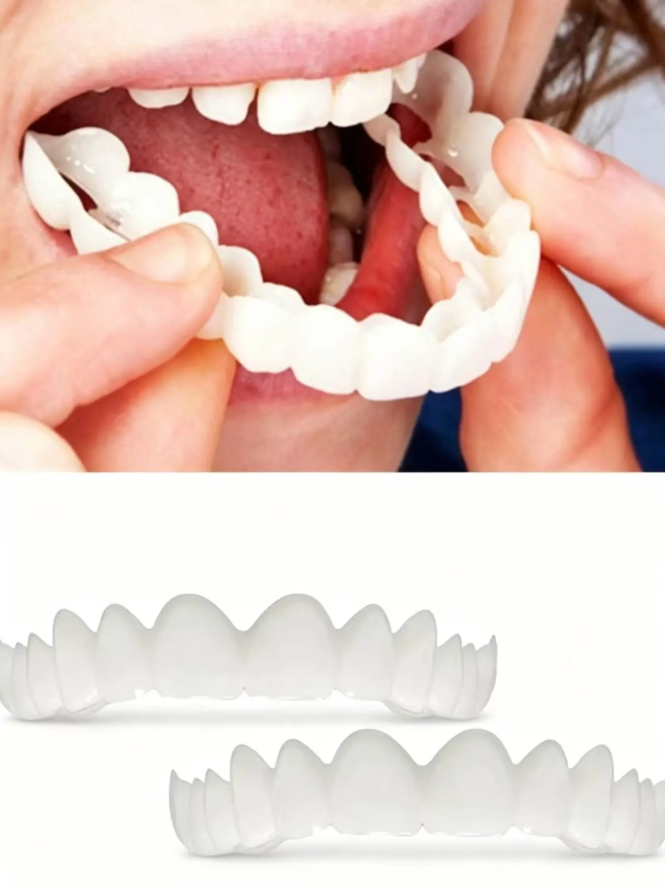 Snap-On Smile Dental Aligner Set, Silicone Material, Teeth Effect, Upper & Lower Jaw Alignment, Second Generation Design