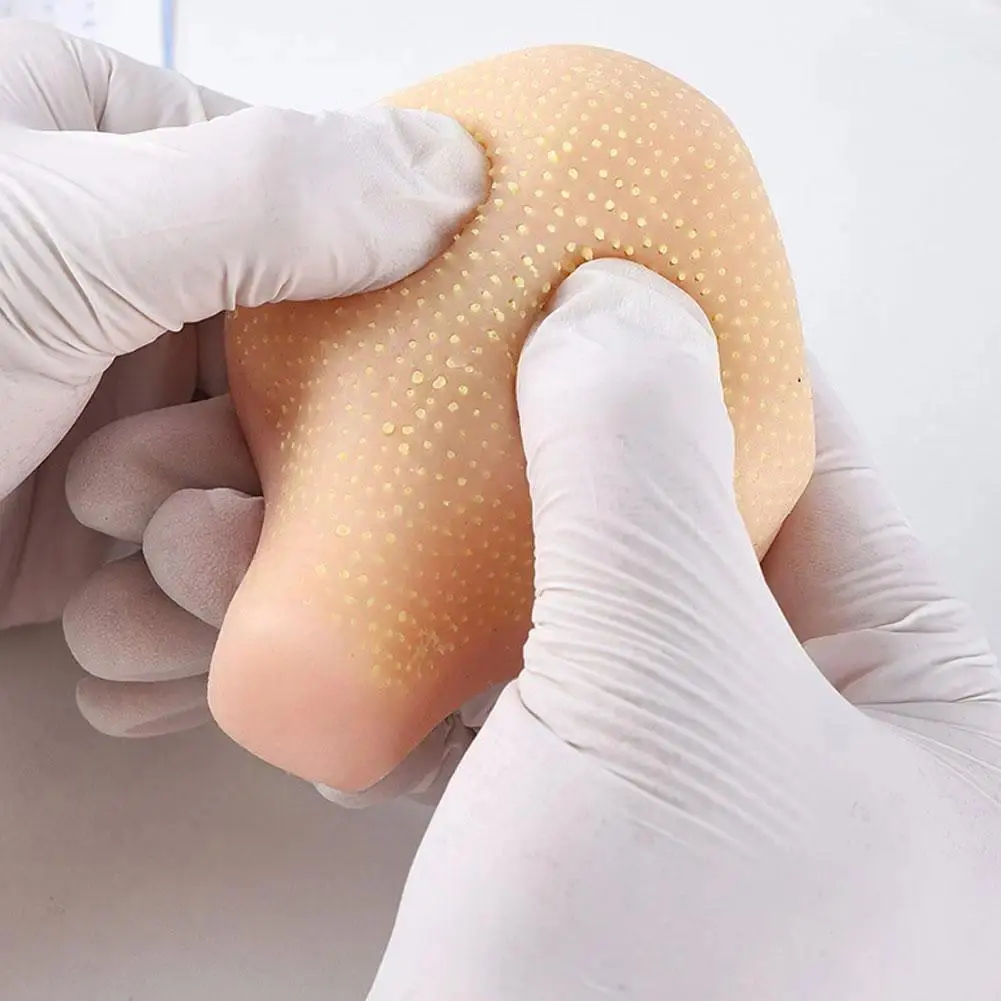 Realistic Pimple Popper Fidget Toy Silicone Sensory Stress Reliever For Anxiety, Simulation Blackhead Squeezing Toy Model, Pocket Stress Relief, Sensory Fidget Tool, Soft Anxiety Fidgets