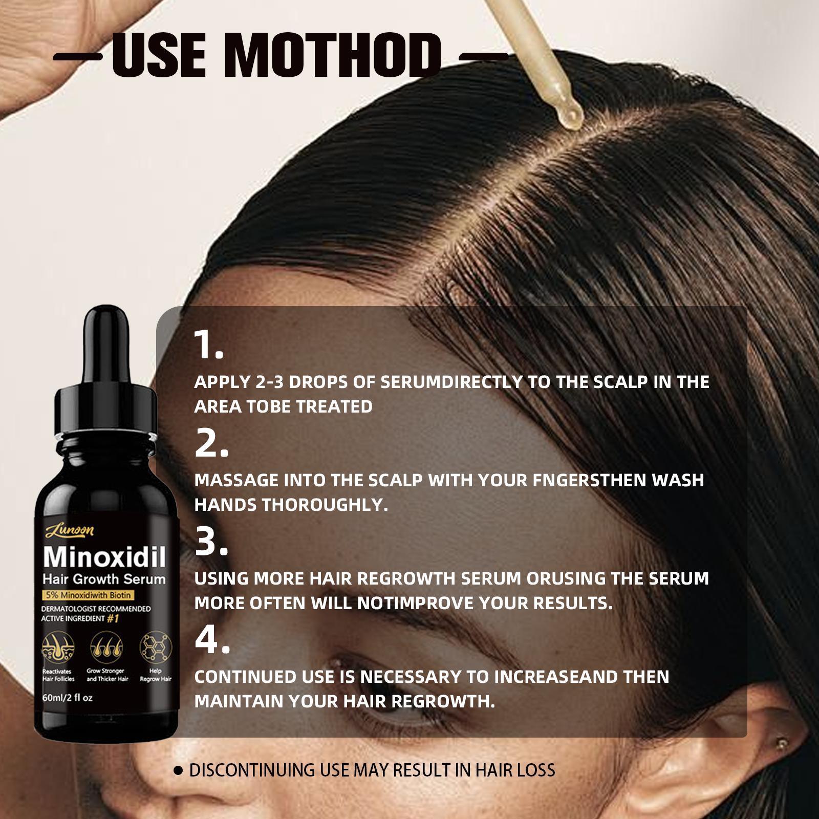 5% Minoxidil Serum, 1 Box/2 Boxes Hair Strengthening Serum, Strengthens Hair, Scalp Treatment Serum, Hair Regrowth Serum, Thicker Looking Hair, Scalp Care Product for Men & Women, Hair Care Product for Daily Use, Haircare