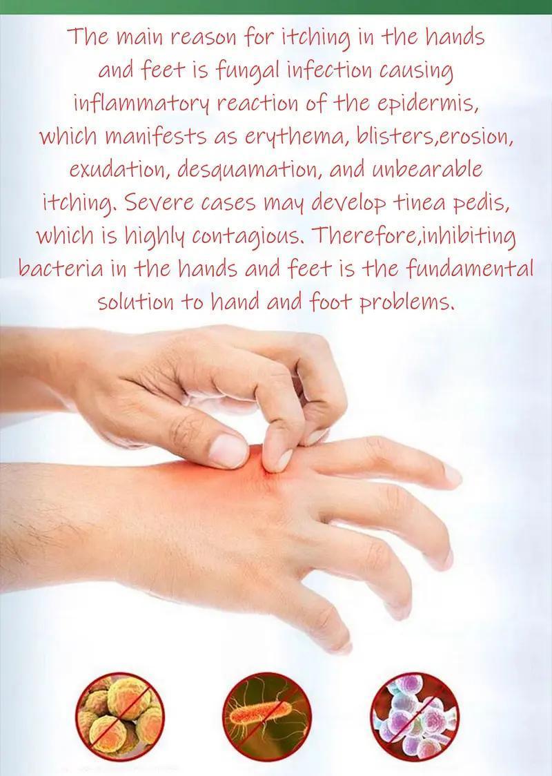 Premium All-Natural Herbal Soothing Cream for Psoriasis, Eczema, Dry & Sensitive Skin Relief | Plant-Based Itch Treatment Balm for Mosquito Bites - 30g