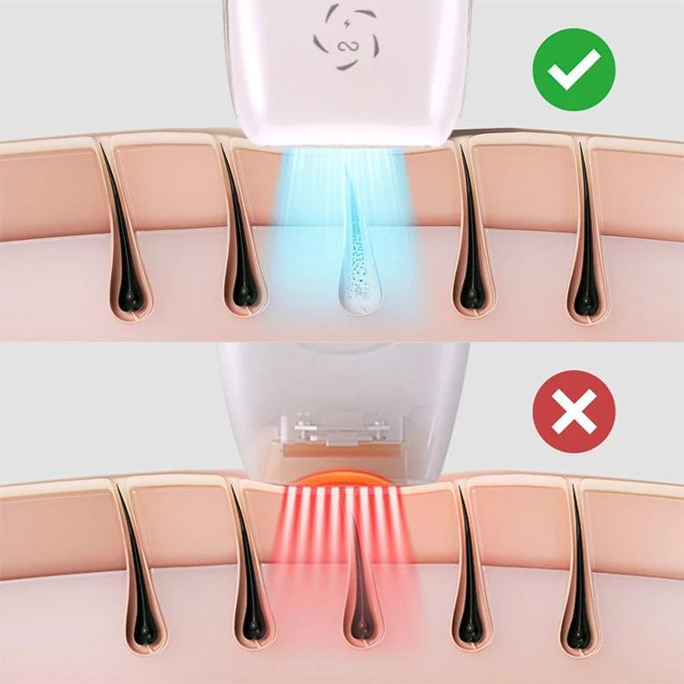 New Trends Dual Pulsed 600nm 72W Sapphire Cooling Freezing Point Hair Remover Laser Hair Removal Instrument IPL Hair Removal