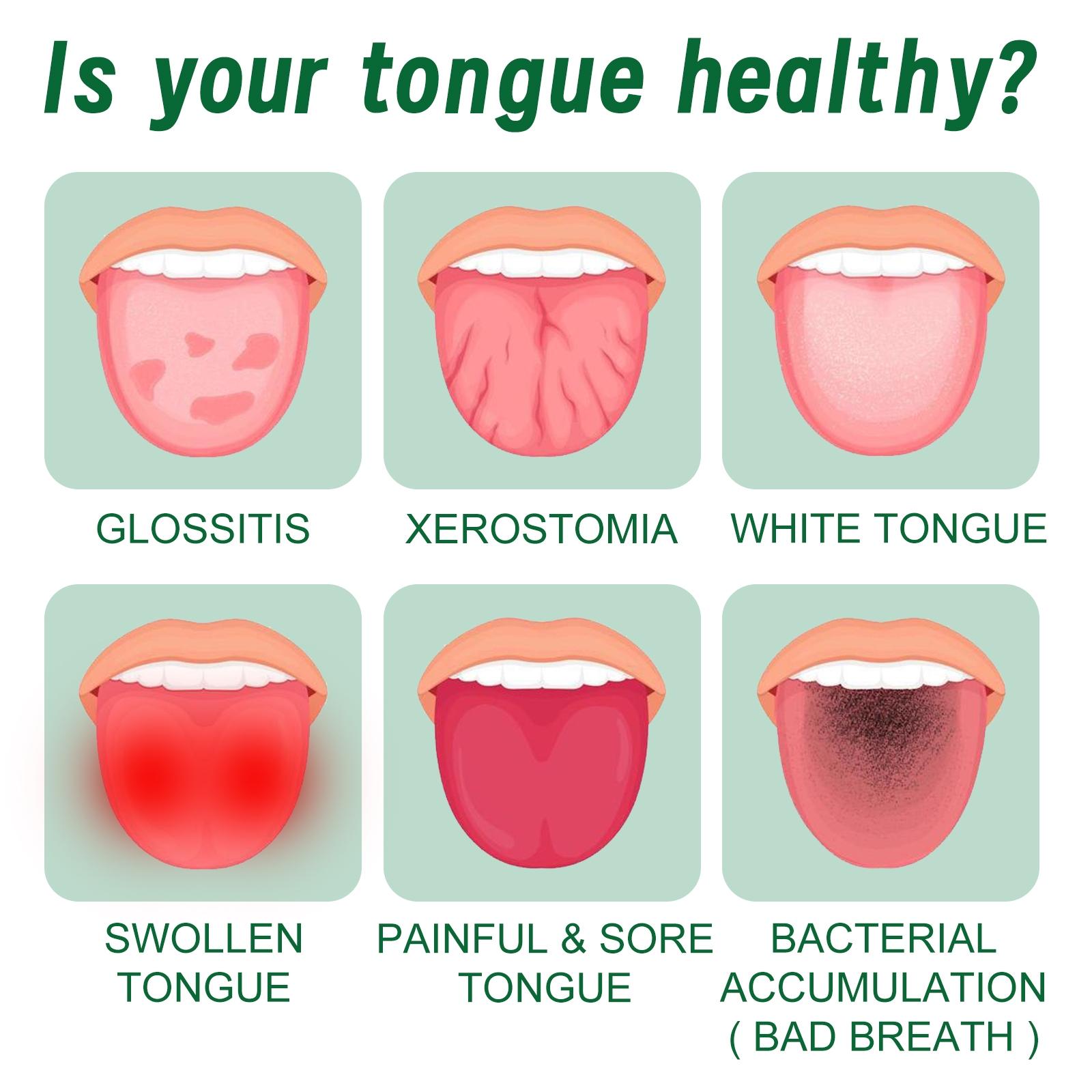 Oral Care Spray, Repair Tongue Coating,Relieve Dry Cracked Swollen Tongue,Tongue Care Spray, Oral HealthMaintenance