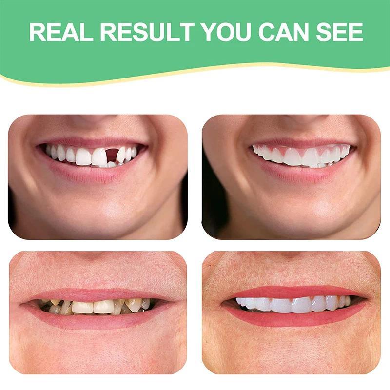Adjustable Denture Teeth Set Perfect Fit Teeth Whitening Snap On Silicone Portable Denture Braces Decorate Gaps Smile Veneers