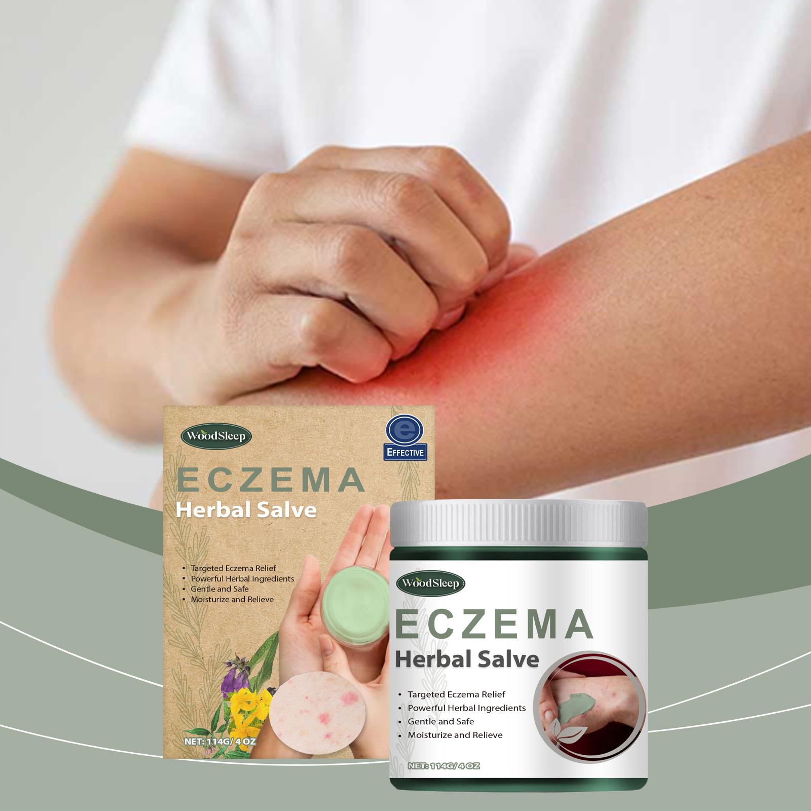 WoodSleep Herbal Cream, Herbal Formula Relieves Skin Redness And Moisturizes Skin Externally