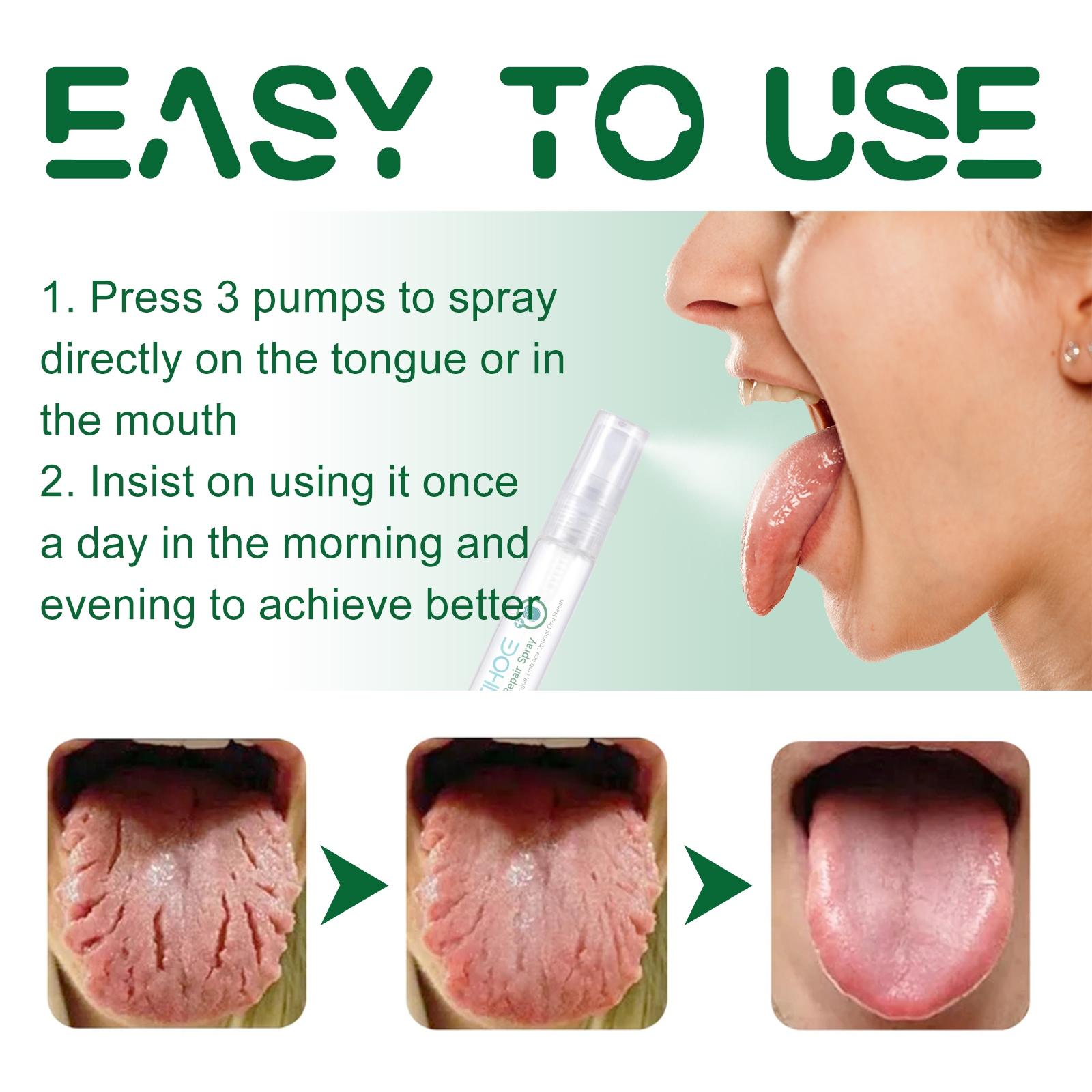 Oral Care Spray, Repair Tongue Coating,Relieve Dry Cracked Swollen Tongue,Tongue Care Spray, Oral HealthMaintenance