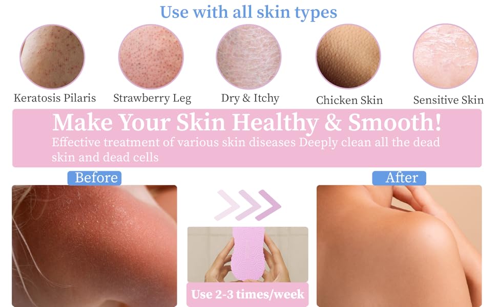 [2 count]Magic Exfoliating Bath Sponge, 3D Super Soft Exfoliating Bath Sponge, Skin Friendly and Reusable, Alternative to exfoliating Gloves, Random Color.Christmas gifts, New Year gifts, Black Friday