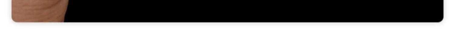 3-meter  adjustable tie-down rope, 10.24 × 2.76 × 1.57 in Motorcycle and electric vehicle handlebar straps, thickened and wide, elastic luggage straps and ropes, multi-functional high elasticity