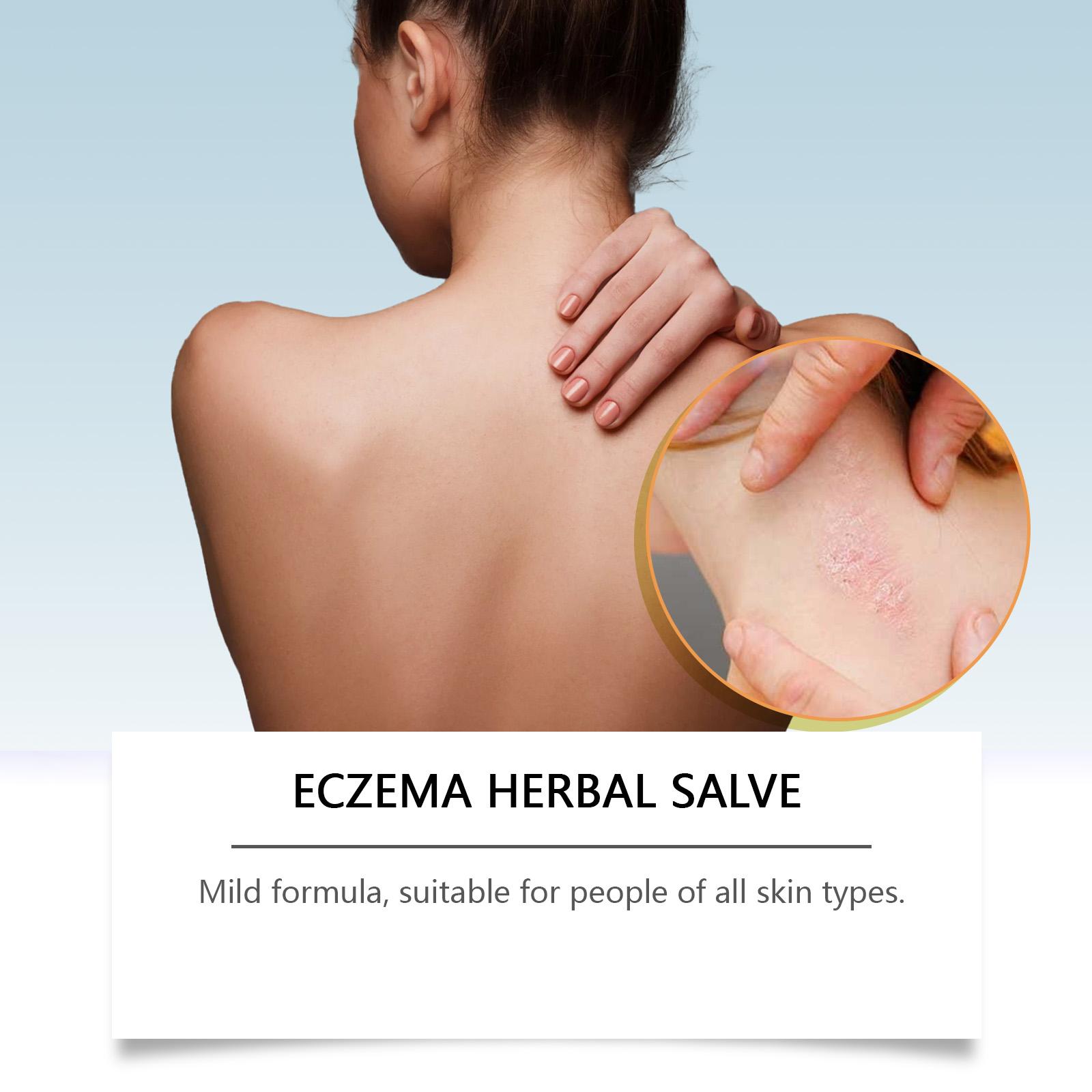 WoodSleep Herbal Cream, Herbal Formula Relieves Skin Redness And Moisturizes Skin Externally