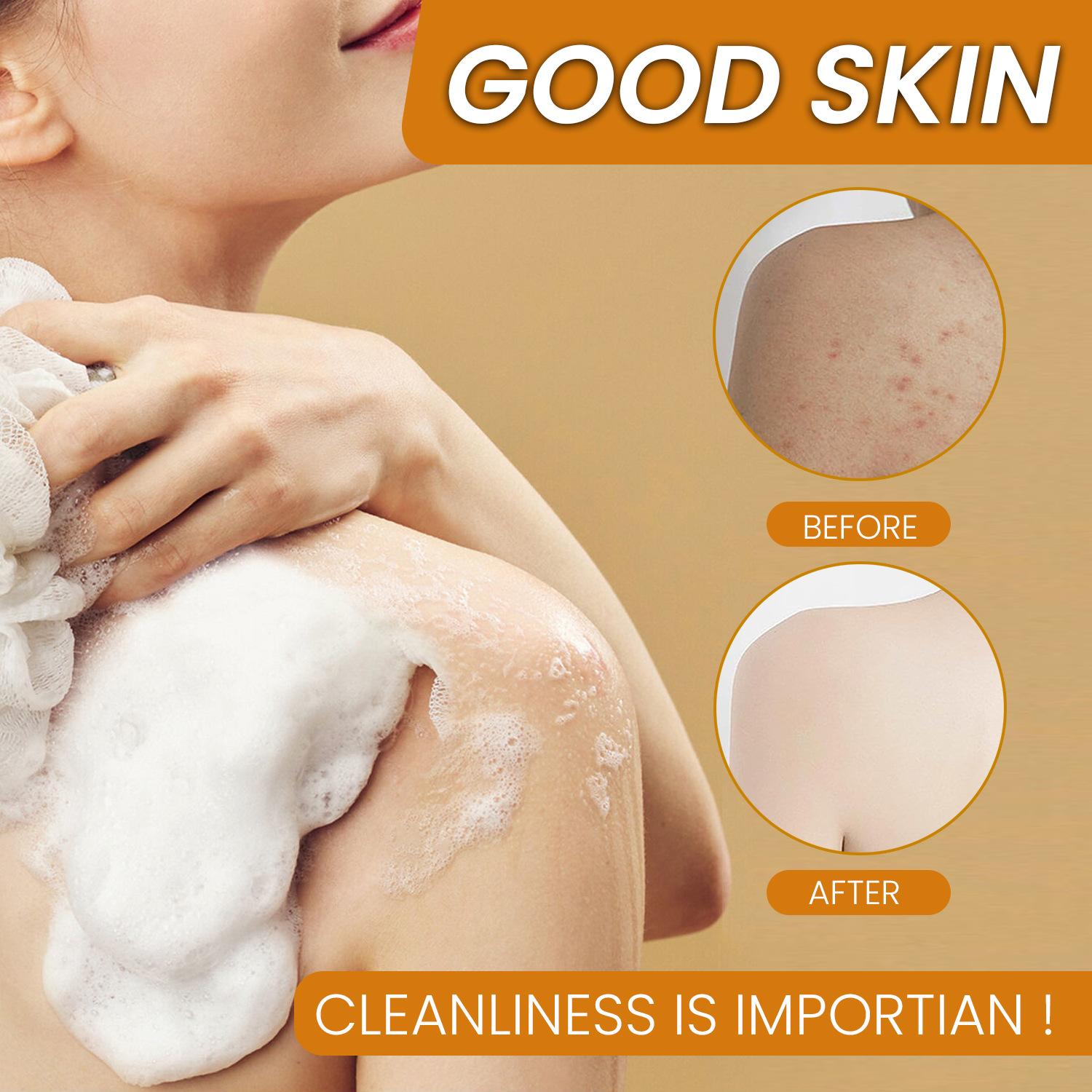 4 Natural Soaps for Glowing Skin Turmeric + Kojic + Lemon + Ginger, Handmade Cold Process, Fades Dark Spots, For Face & Body, No Harsh Chemicals