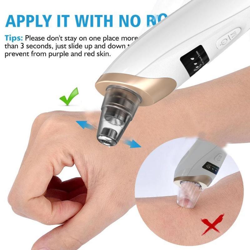 Electric Blackhead Remover, Rechargeable Blackhead Extractor, 3 Levels Adjustable Suction Power, Suction Head, Facial Skin Care Tool, Comfort Electric Blackhead Remover, Rechargeable Blackhead Extractor, 3 Levels Adjustable Suction Power, Suction Head, Facial Skin Care Tool, Comfort
