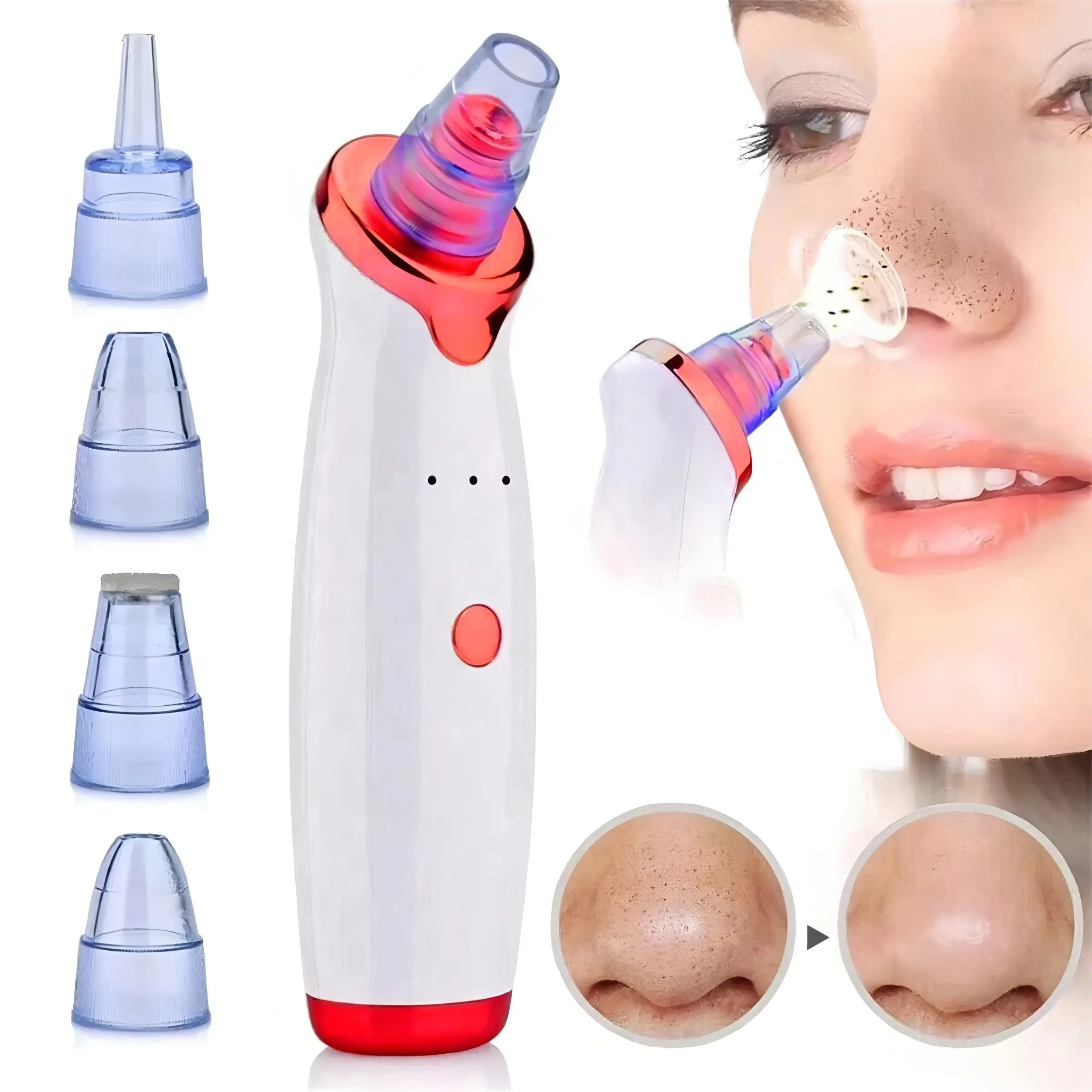 Blackhead Remover, Blackhead Extractor, Pore Vacuum Cleaner, Electric Blackhead Removal Tool Kit, USB Interface, for Facial Acne Whiteheads Extraction