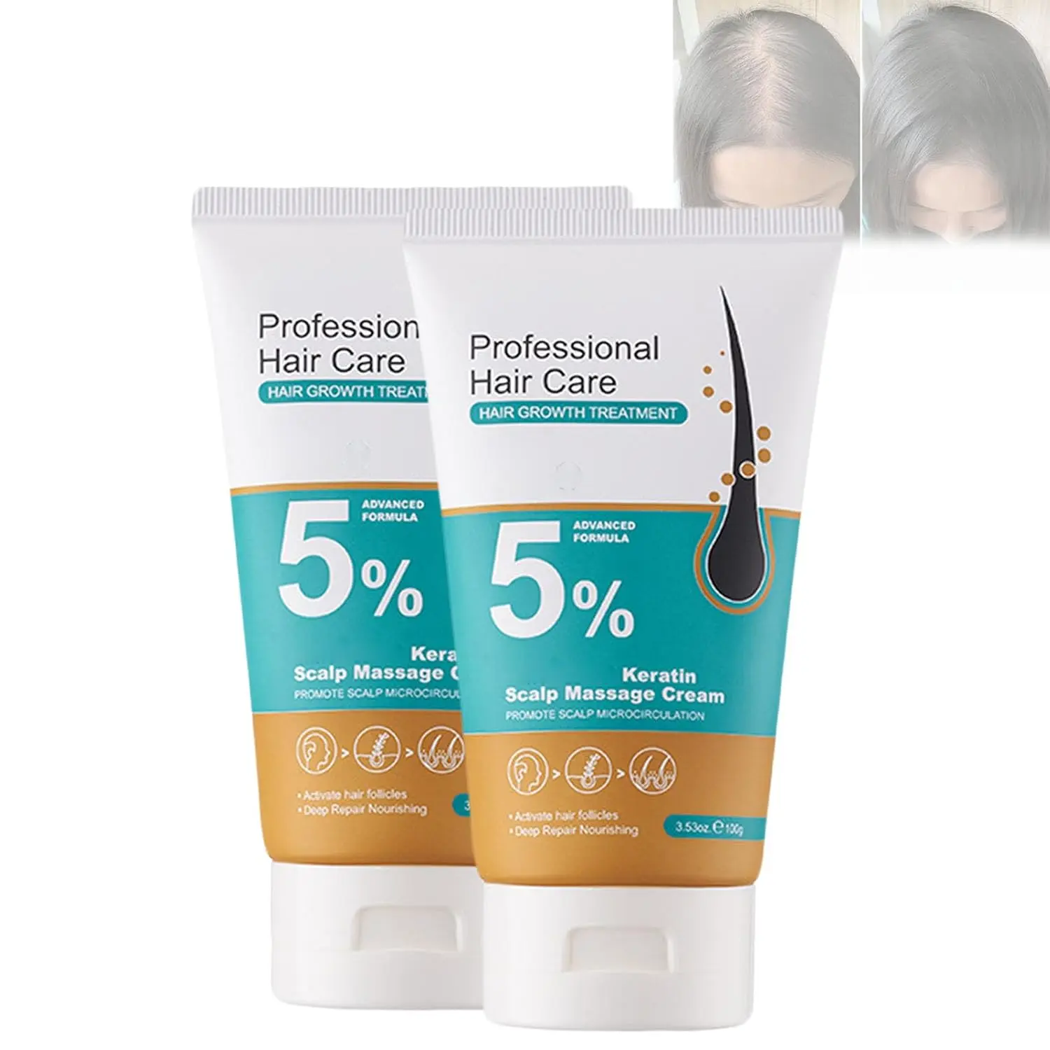 Buy 1 Get 1 Free 5% Minoxidil Hair Growth Scalp Massage Cream, Cream ...