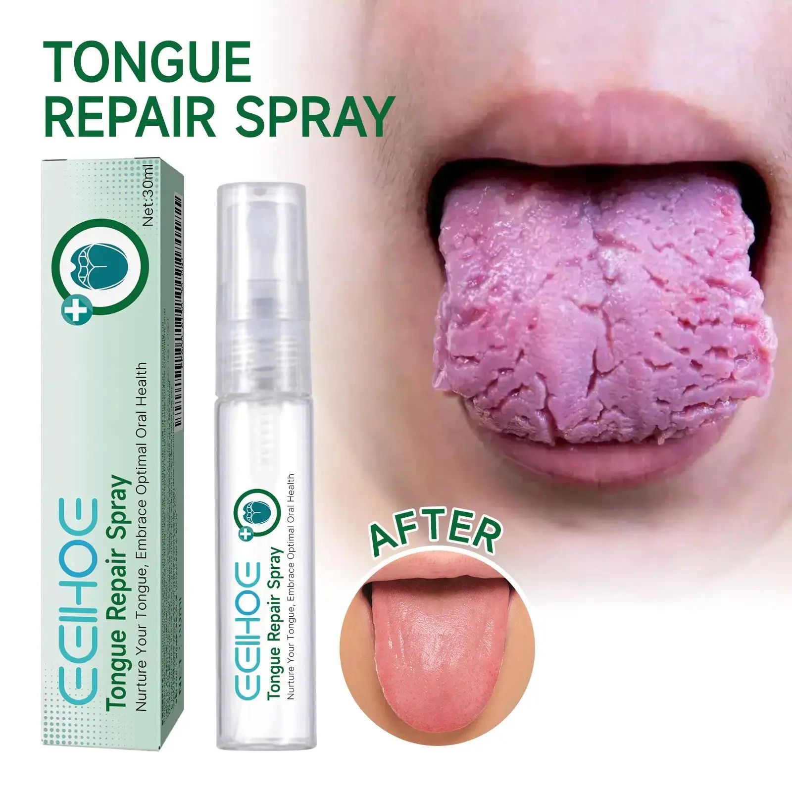 EELHOE 30g Peppermint Oral Spray - Antibacterial Daily Oral Care, Fresh Breath, Bad Breath Relief, White Coating Removal, Dry Mouth Hydration & Restoration, Restore, Direct Spray