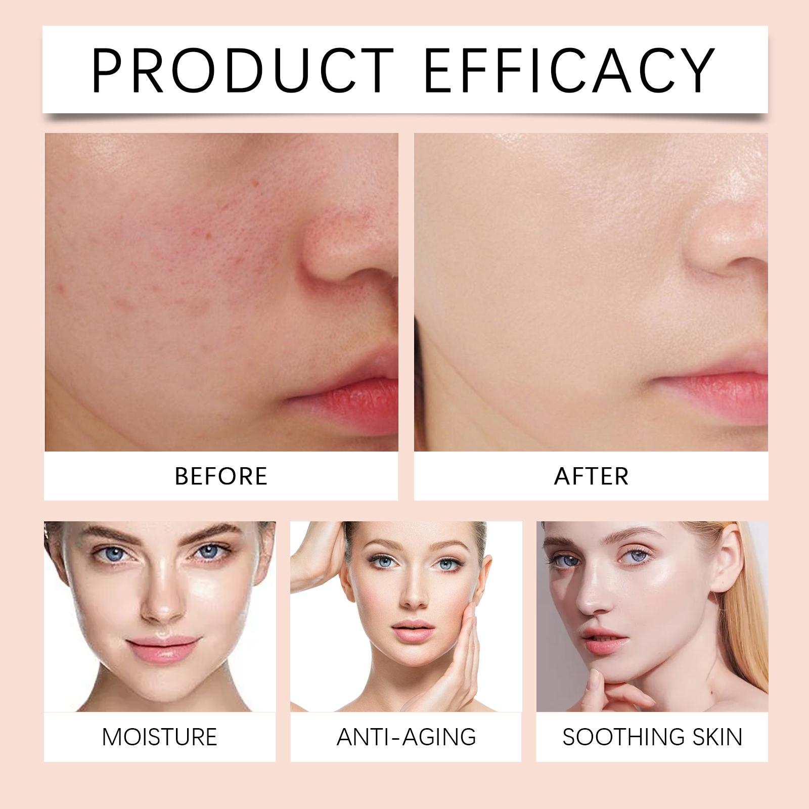 West Month Turmeric Moisturizing Face Cream, Brightening, Hydrating, Nourishing And Moisturizing Skin Daily Gentle Care