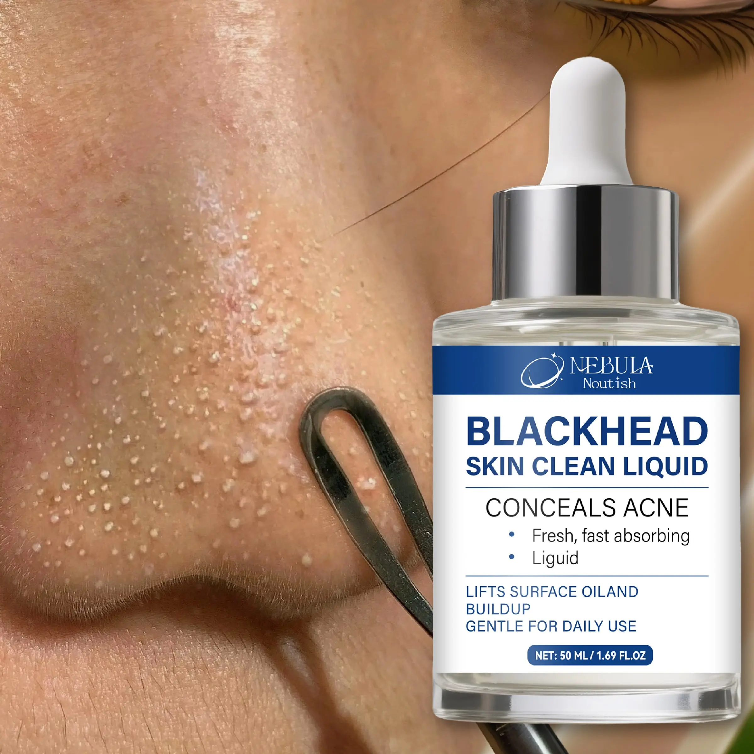 Blackhead Clearing Liquid, Dissolves Oil, Unclogs Pores, Removes Blackheads and Acne, Refreshes and Controls Oil, Original Solution