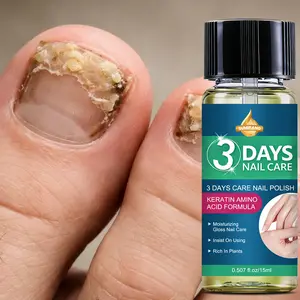SUMFANG 3-Day Nail Polish 15ml – Vitamin C + Salicylic Acid + Keratin – Repairs brittle & dull nails – Enhances natural shine & hydration – Suitable for daily nail care for men and women