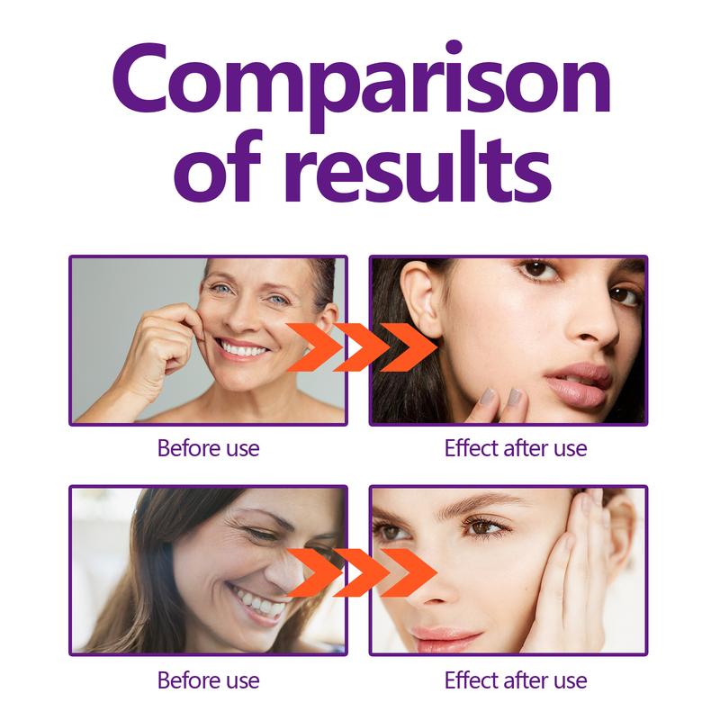 Hoygi Instant Face Lift Cream, Reduce Fine Lines On The Face With Gentle Moisturizing Cream For Wrinkled Skin pimplepatches