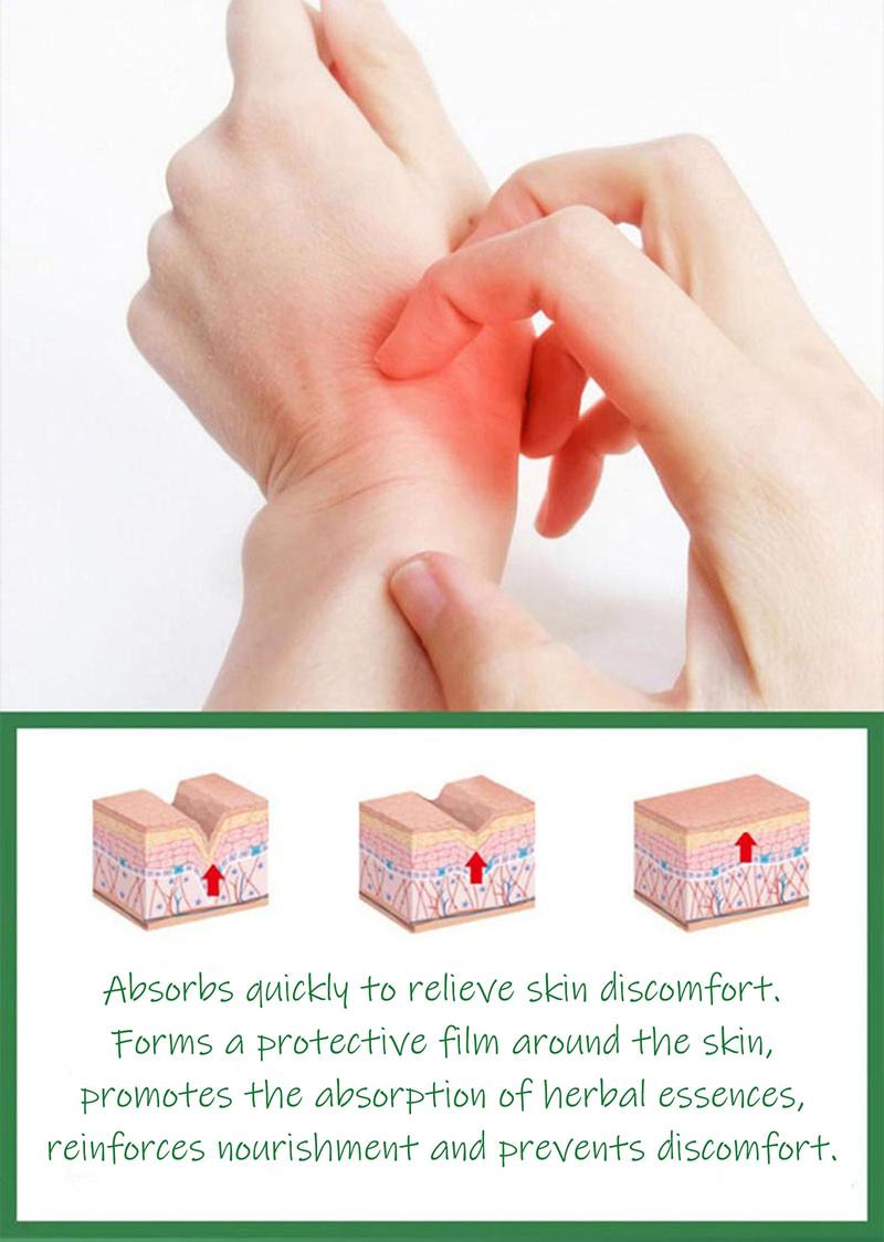 SanNuo Herbal Antibacterial Soothing Cream – Relieves Eczema, Psoriasis & Itching, Safe for Dry & Sensitive Skin, Zero Hormone & Fragrance-Free Creme for Eczema