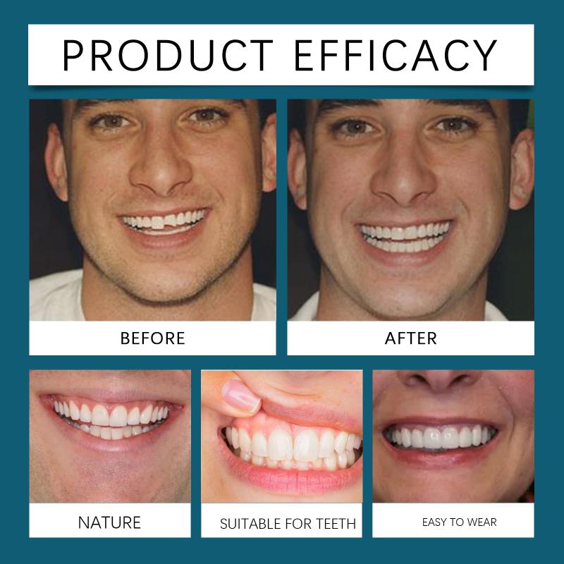 Silicone Denture Repair Kit - Daily Use to Enhance Smile Beauty, Comfortable Material to Modify Teeth.