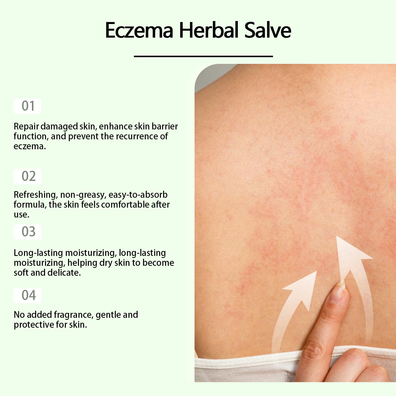 WoodSleep Herbal Cream, Herbal Formula Relieves Skin Redness And Moisturizes Skin Externally