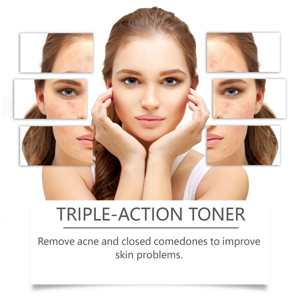 Acne-fighting, Pore-cleansing Salicylic Acid Toner Nourishes The Skin Repairs The Skin Barrier And Contains Gentle Ingredients
