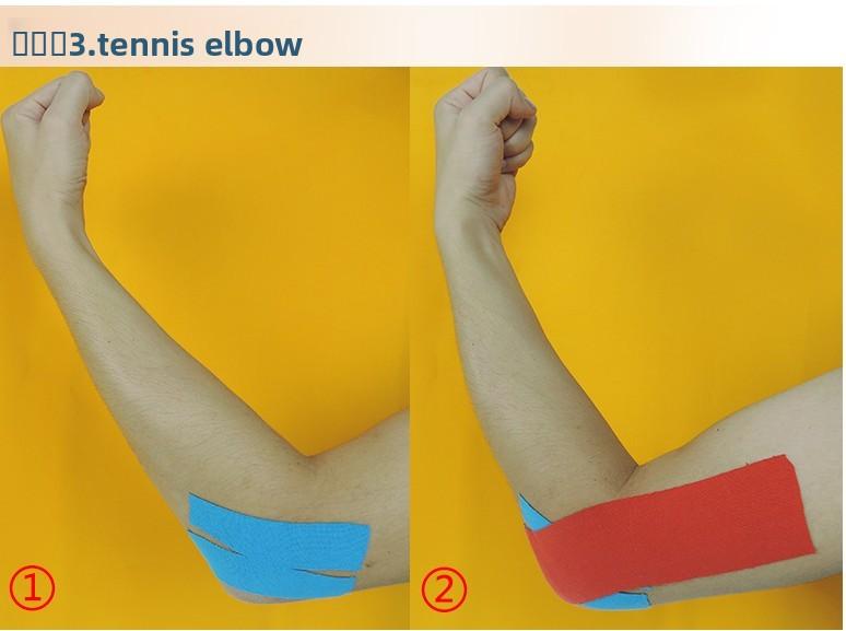 Muscle patch Athlete special strain bandage Achilles tendon muscle patch Self-adhesive tape Internal effect patch Basketball badminton