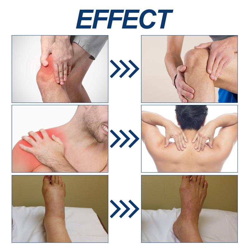 Ximonth Bee Venom Joint Neck Cream Relieve Lumbar Spine Knee Arthralgia and Myalgia Muscle Soreness Joint Neck Cream