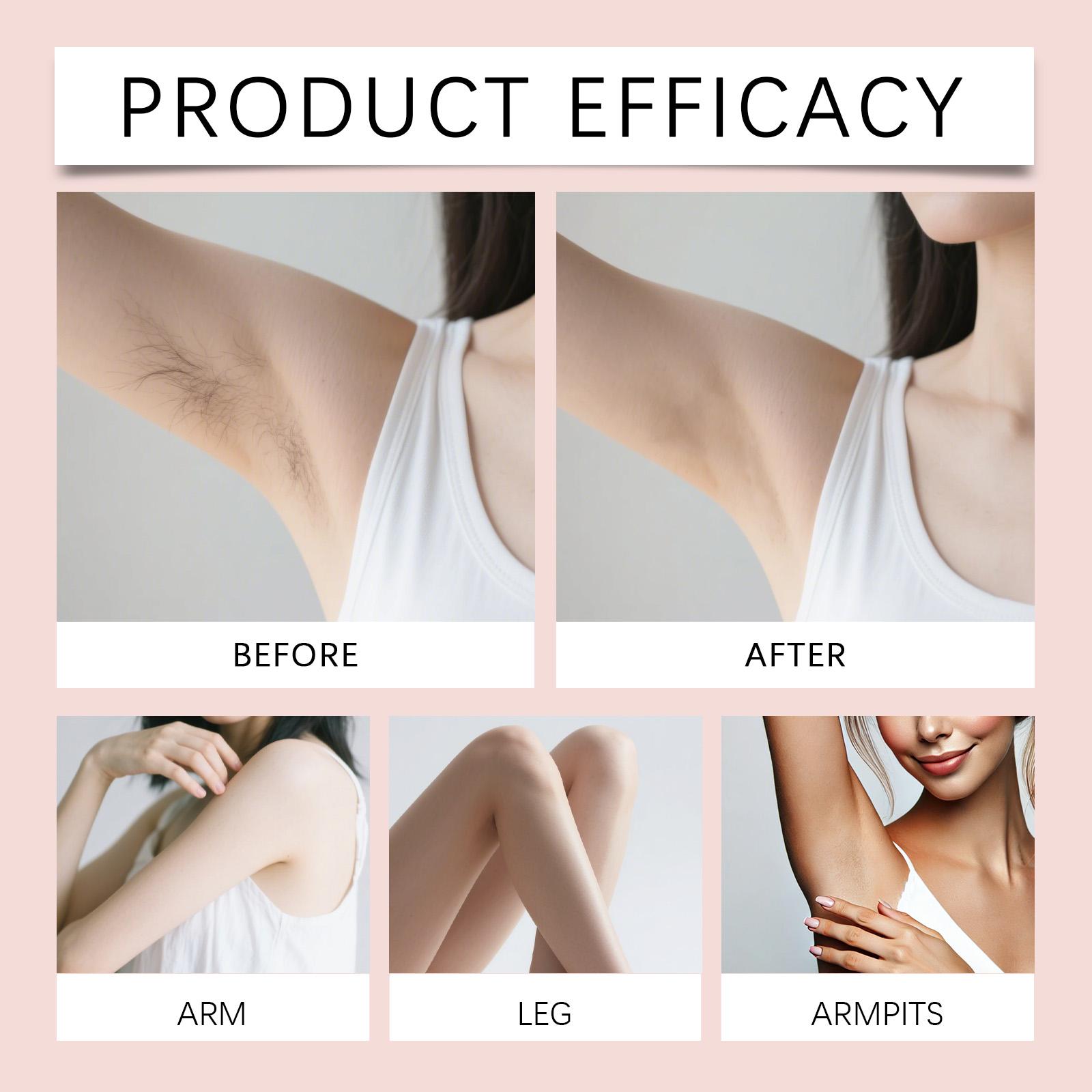 Unisex body hair removal cream gently cleanses and smooths the skin, removes hair without irritation, and leaves the skin hydrated, comfortable, and refreshed