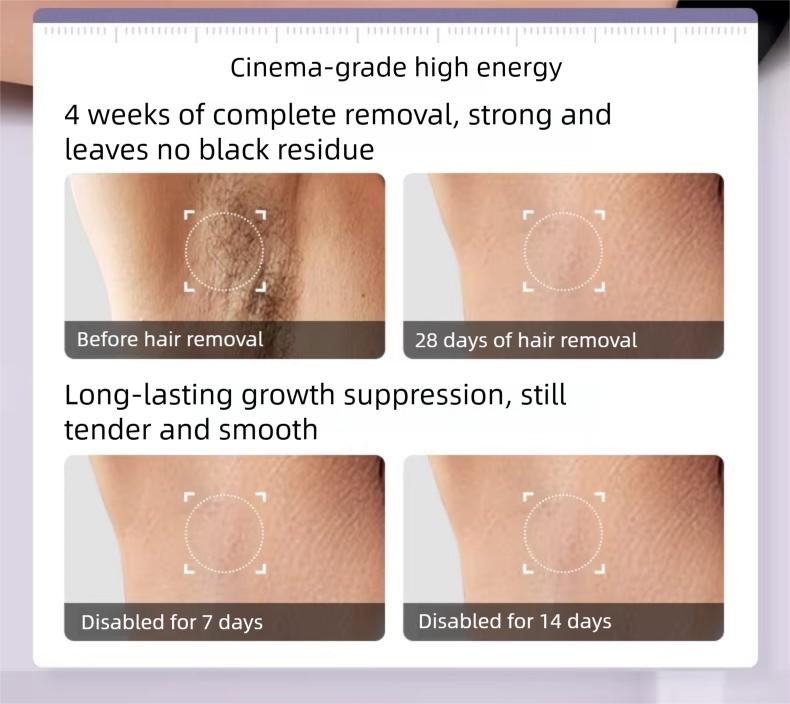 IPL Laser Hair Removal Device with Sapphire Ice-Cooling Technology for Women & Men, Painless & Long-Lasting Hair Remover for Full Body Use at Home, Safe on Face, Bikini Line, Armpits