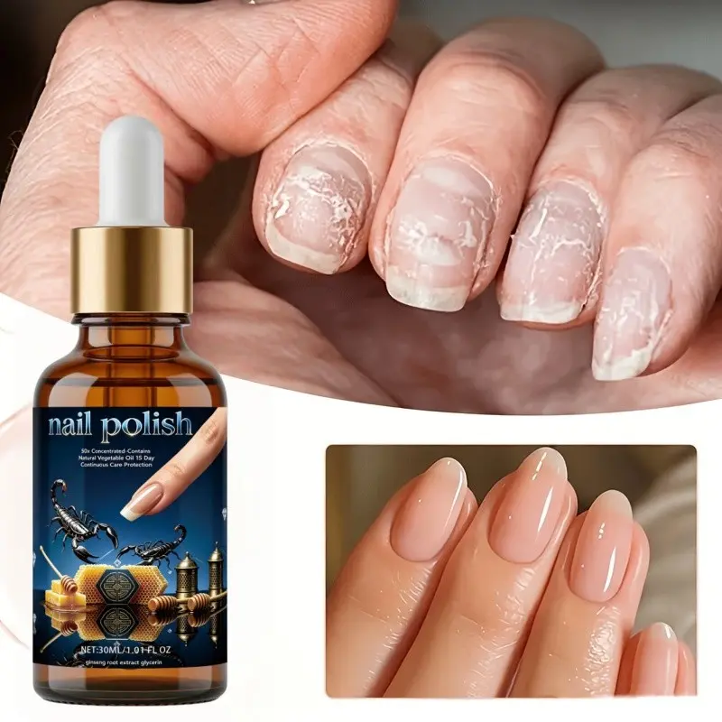 Nail Care Essence 30ML, 24-Hour Continuous Care, Moisturizing, Brightening Nails, Improves Brittle, Dull, Rough Nails, Suitable for Damaged Nails, Nail Repair Solution, Nail Strengthener
