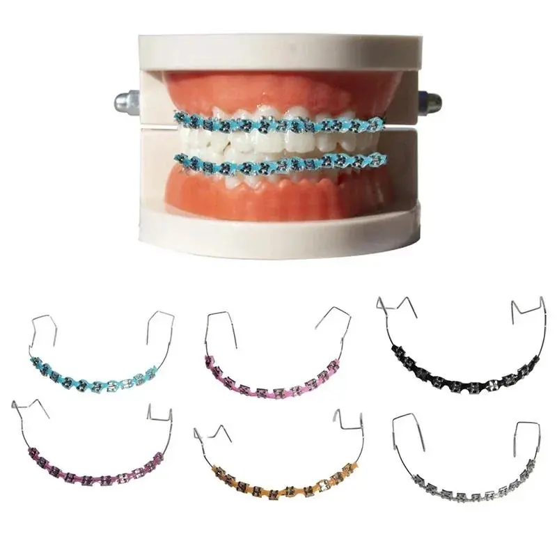 1 Pair Fashion Braces Colorful Temporary Tooth Decoration with Metal Wires Metal Bracket Orthodontic Ligature Ties High Quality Mouth