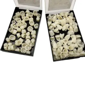 Dental Temporary Teeth/Crowns – Porcelain-style Crowns, Veneers, and Facings (Anterior & Posterior) – Dental Materials