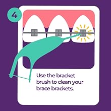 Orthodontic Flossers for Braces, 30 Count (Pack of 2), Ortho Picks for Adults & Kids, Fits Under Arch Wire, Non-Damaging, Encourage Flossing Habits