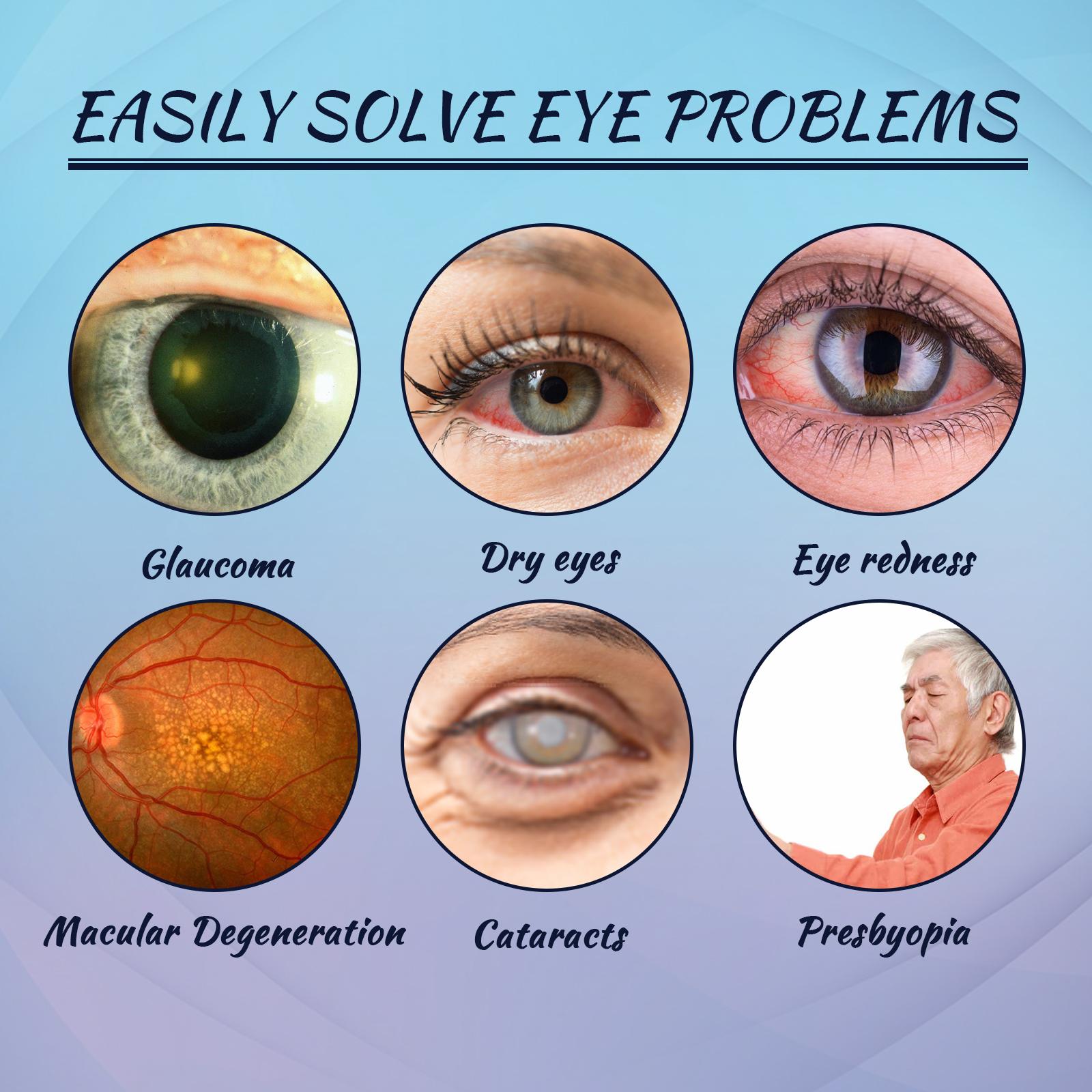 Dry Eye Therapy Lubricating Eye Drops for Dry Eyes, Preservative Free eye drops, 10 Single-Use Vials