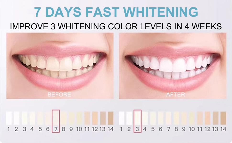 Skynii Hydroxyapatite Toothpaste, 10% Nano Hydroxyapatite Toothpaste, Natural and Fluoride-Free, Gentle on Sensitive Teeth and Strengthens Enamel, Freshens Breath (2)