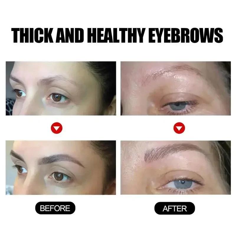 Fast Eyebrow Growth Serum Eyelash Hair Growth Anti Hairs Loss Product Prevent Baldness Fuller Thicker Lengthening Eyebrow Makeup Fast Eyebrow Growth Serum Eyelash Hair Growth Anti Hairs Loss Product Prevent Baldness Fuller Thicker Lengthening Eyebrow Makeup