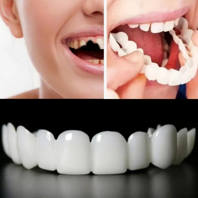 2pcs Flexible White Comfortable Mouth Guards with Upper and Lower Attachments, Unisex Easy-to-Wear Dental Protection Solution for Enhanced Confidence