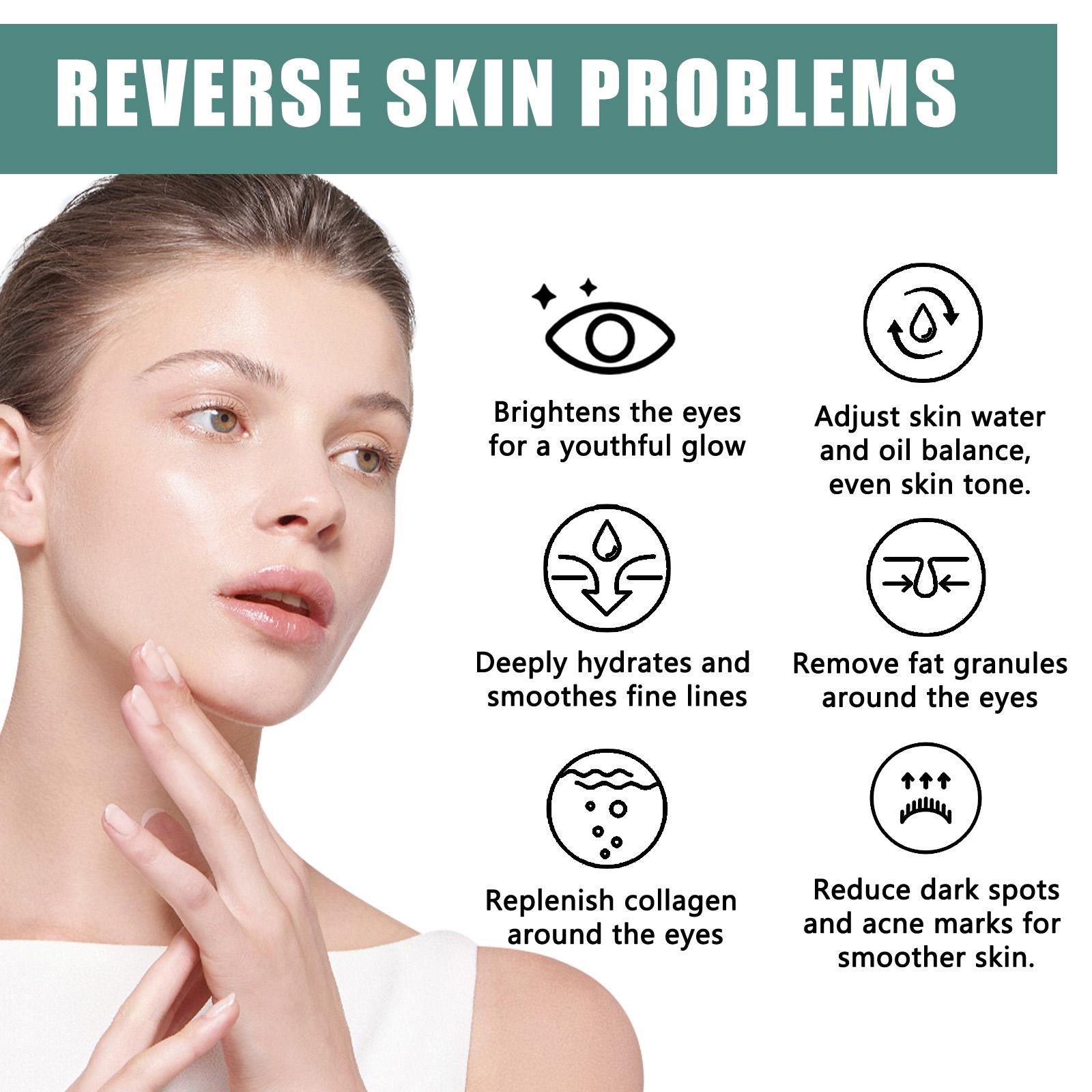 EELHOE Anti-Wrinkle Eye Cream Protects The Skin Around The Eyes And Reduces Dark Spots, Dry Lines And Fine Lines