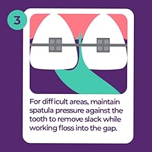 Orthodontic Flossers for Braces, 30 Count (Pack of 2), Ortho Picks for Adults & Kids, Fits Under Arch Wire, Non-Damaging, Encourage Flossing Habits Orthodontic Flossers for Braces, 30 Count (Pack of 2), Ortho Picks for Adults & Kids, Fits Under Arch Wire, Non-Damaging, Encourage Flossing Habits