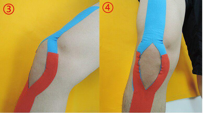 Muscle patch Athlete special strain bandage Achilles tendon muscle patch Self-adhesive tape Internal effect patch Basketball badminton