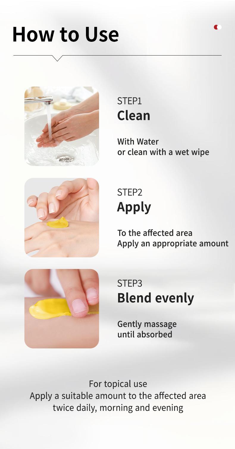 SanNuo Herbal Antibacterial Soothing Cream – Relieves Eczema, Psoriasis & Itching, Safe for Dry & Sensitive Skin, Zero Hormone & Fragrance-Free Creme for Eczema