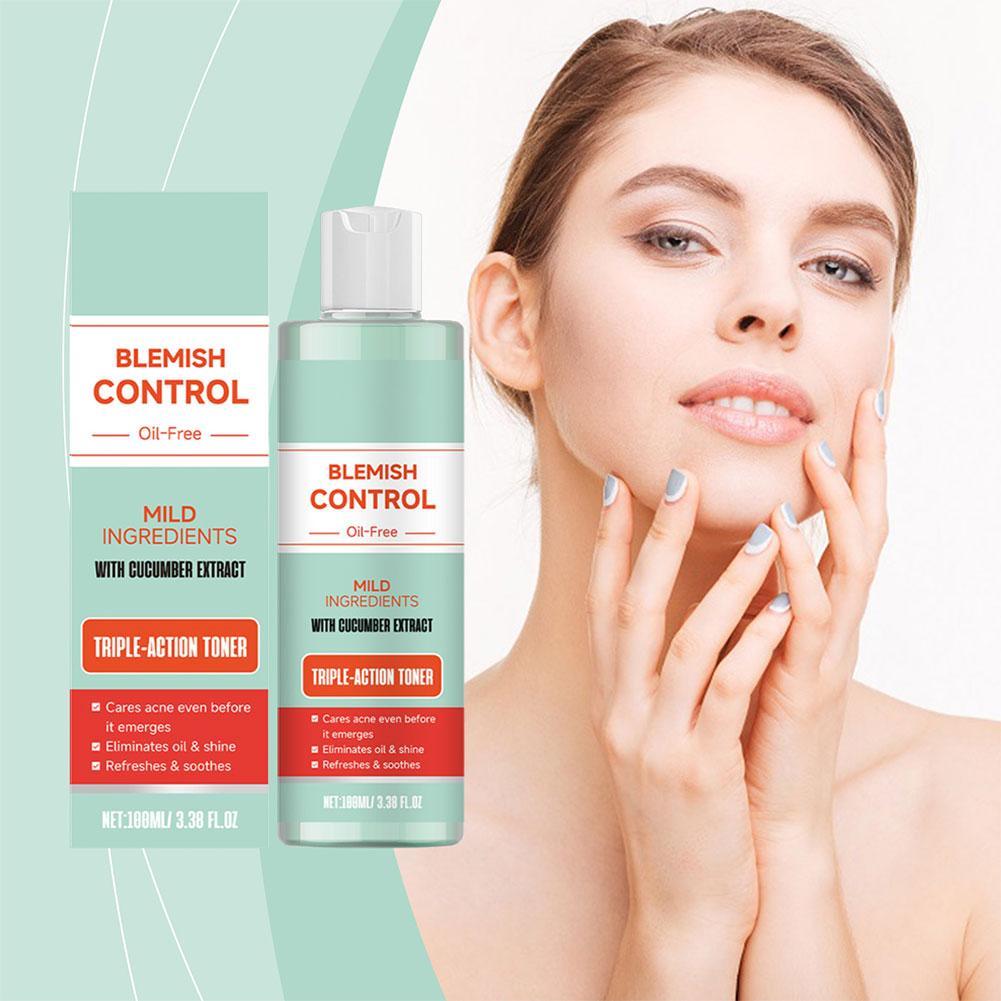 Acne-fighting, Pore-cleansing Salicylic Acid Toner Nourishes The Skin Repairs The Skin Barrier And Contains Gentle Ingredients Acne-fighting, Pore-cleansing Salicylic Acid Toner Nourishes The Skin Repairs The Skin Barrier And Contains Gentle Ingredients