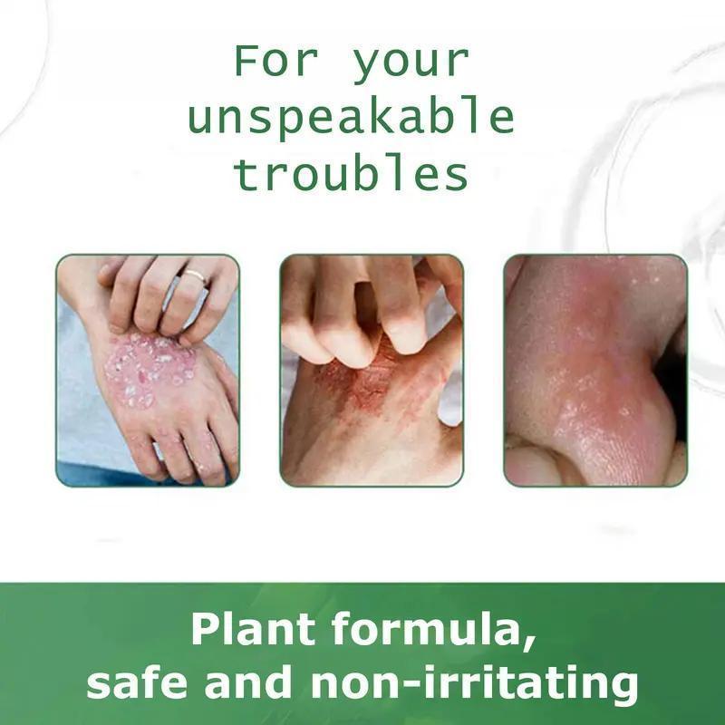 Premium All-Natural Herbal Soothing Cream for Psoriasis, Eczema, Dry & Sensitive Skin Relief | Plant-Based Itch Treatment Balm for Mosquito Bites - 30g