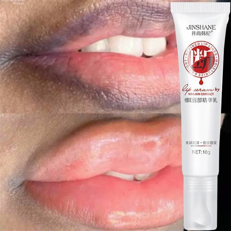 Remove Dark Smoke Lips Pink Fresh Lightening Bleaching Cream Treatment Lip Balm  Moisturizer Nourishing Essence Lips
