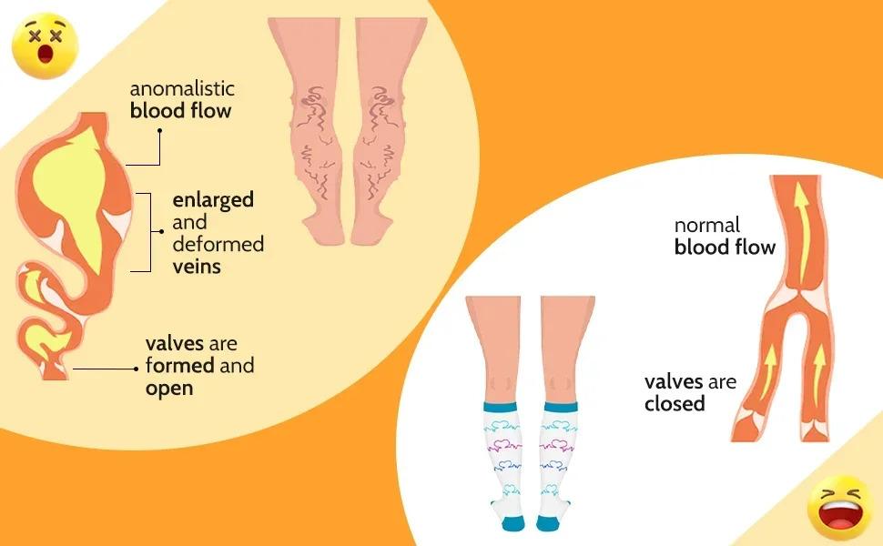 Struggling with swelling?Get these 3 pairs of plus size compression socks 20-30 mmHg support for wide calves and better circulation Struggling with swelling?Get these 3 pairs of plus size compression socks 20-30 mmHg support for wide calves and better circulation