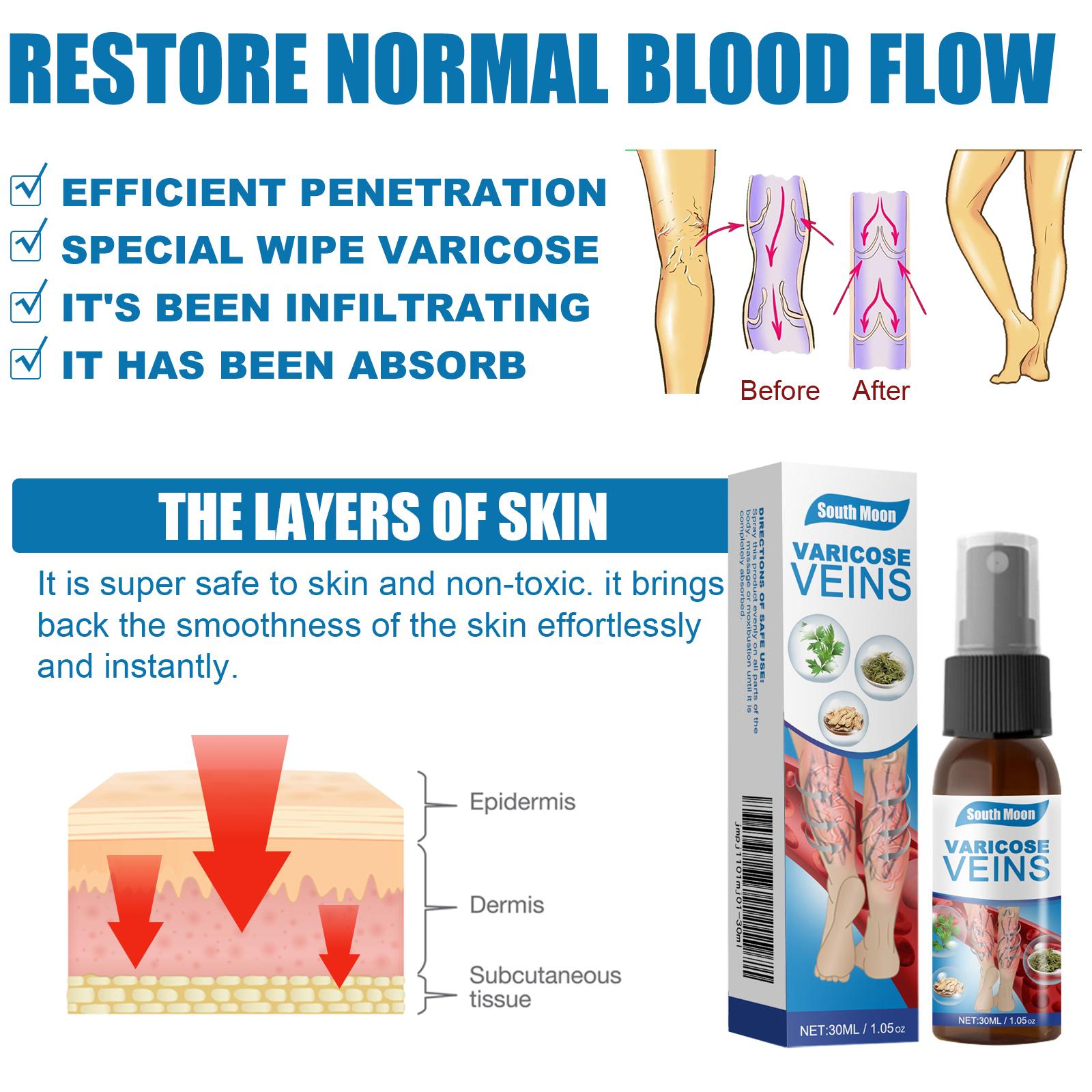 South Moon Leg Care Spray Gently Relieve Leg Discomfort, Blue Veins And Bumps Repair Daily Care