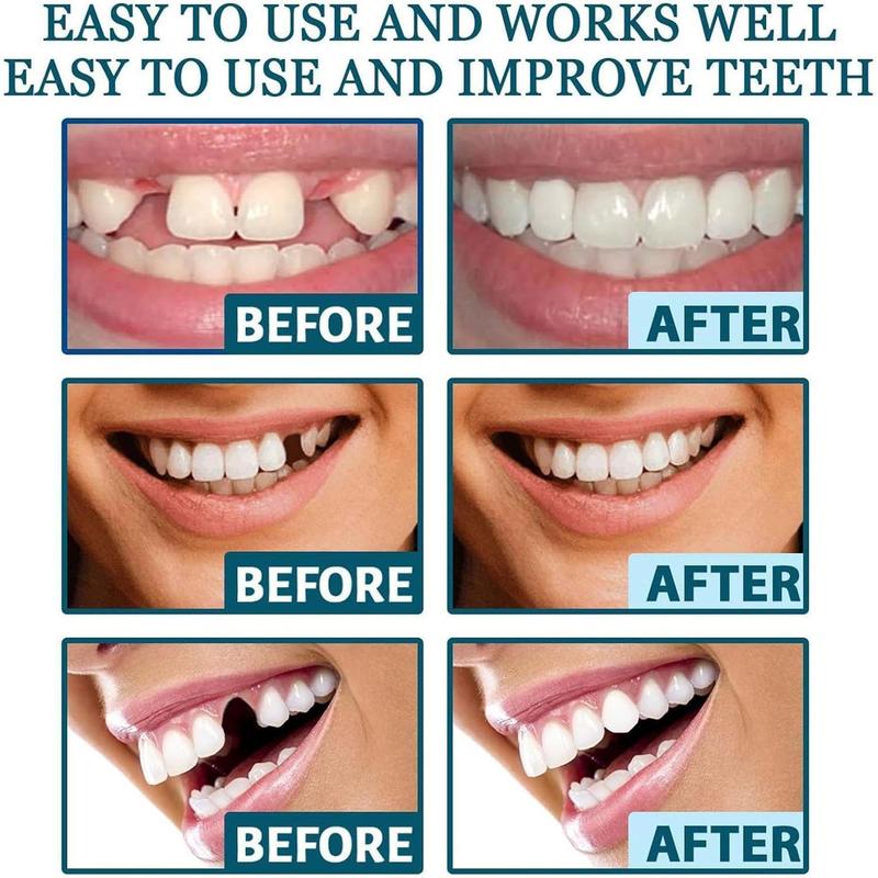 Veenora Clip on Veneers, Minceetbien Dentures, Snap On Veneers Silicone Kit for Both Upper and Lower, Silicone Reline Denture Set (2Set)