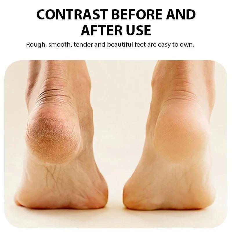 Rechargeable Electric Foot Grinder Dead Skin Remover Calluses Feet Scrubber Electric Foot File Dry Dead Cracked Foot Care Repair  Christmas gift Christmas Supplies